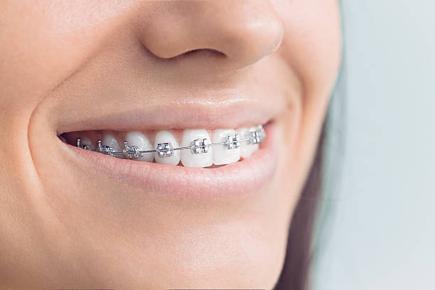 Best Root Canal Treatment  in Batesville, IN